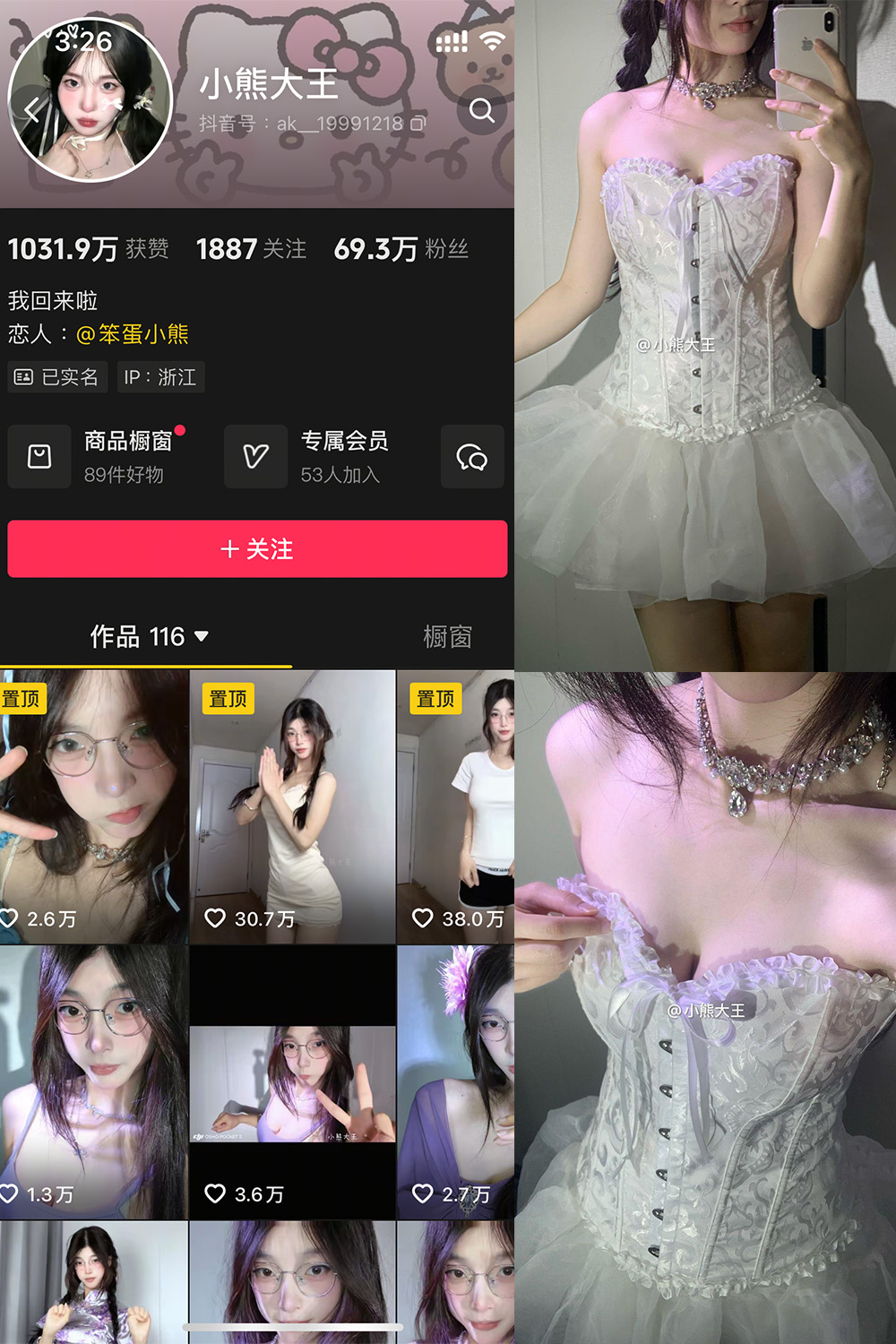 抖音 小熊大王 微密圈 001期 【32P】-珊瑚兔