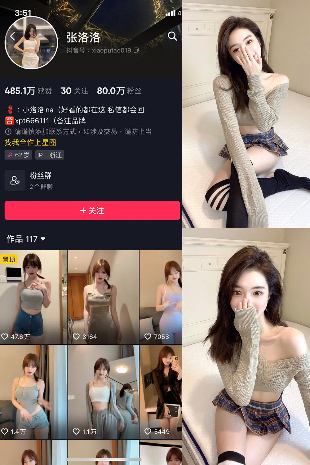 抖音 张洛洛 微密圈 NO.002期 【27P】-珊瑚兔