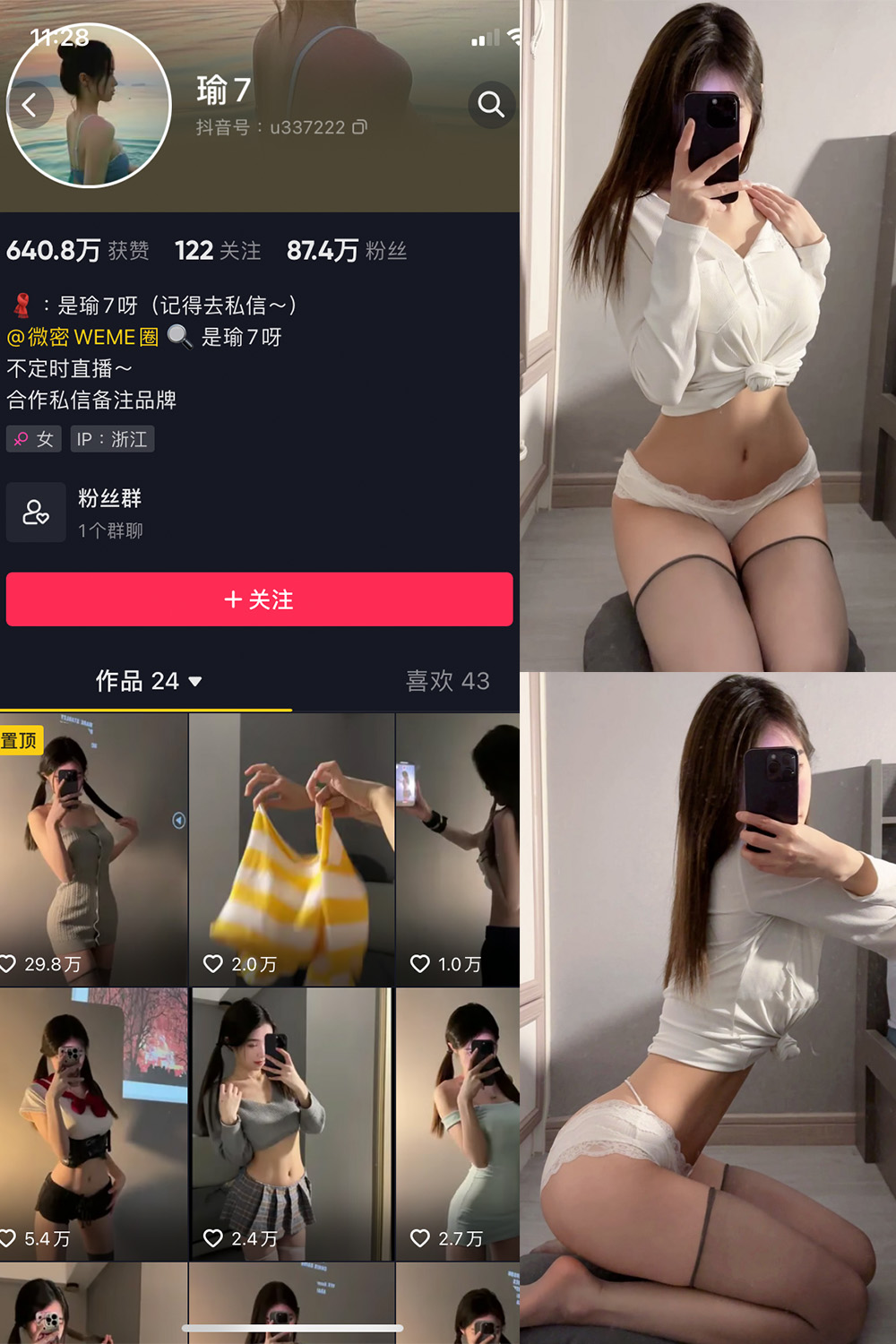 抖音 瑜七 微密圈  NO.011期 【15P】最新至：2024.7.6-珊瑚兔